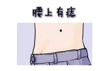 右腰痣